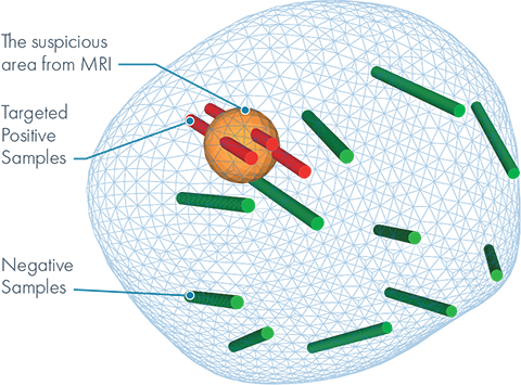 Biopsy Accuracy Graphic